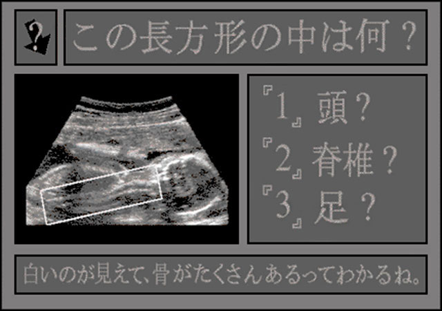 screenshot showing the interface, in Japanese, prompting the user to identify a highlighted part of a fetal ultrasound